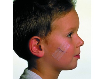 Reinforced steri strip 3M