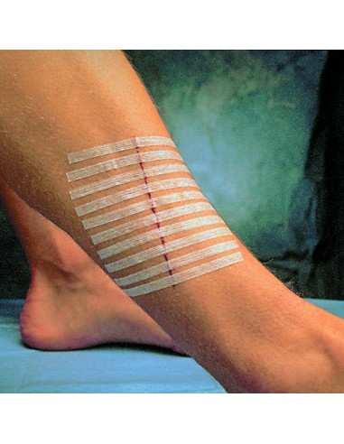 Reinforced steri strip 3M Reinforced steri strip 3M