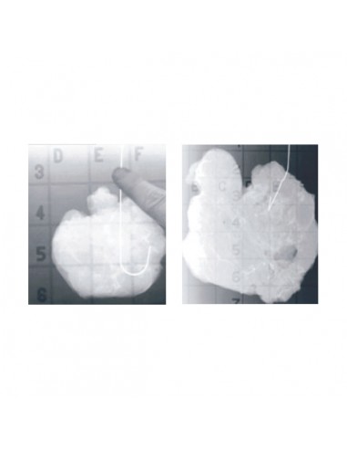 Grille radio-opaque ép. 30mm de transport des tissus du sein VVX3P Boîte de 10 - Livré avec Pins Grille radio-opaque ép. 30mm de transport des tissus du sein VVX3P Boîte de 10 - Livré avec Pins