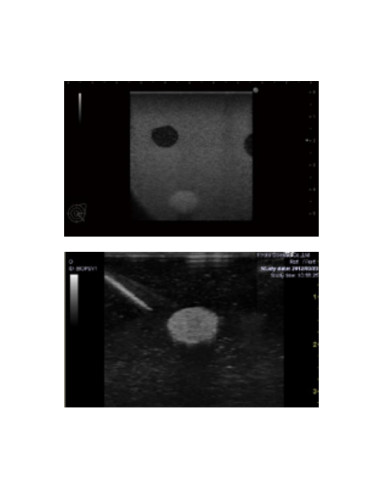 Set of two breast phantoms 1 transparent and 1 opaque for training in biopsy under echography Set of two breast phantoms 1 transparent and 1 opaque for training in biopsy under echography