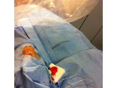 Radpad x-ray shield 90% eq pb 0,125mm 37x42cm radial access Leadfree - stérile - box of 15